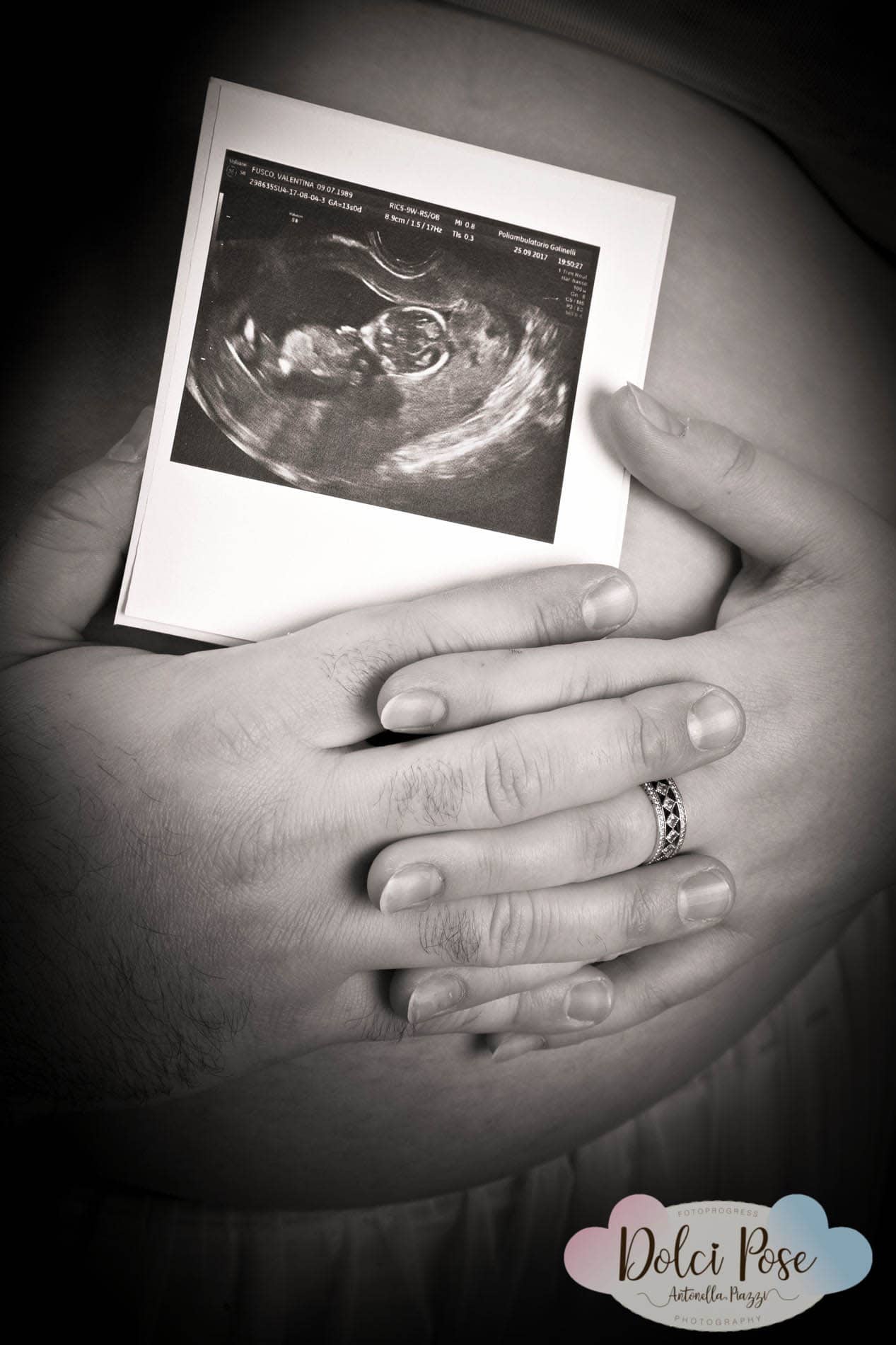 IMG_7436ok_newborn-neonati-fotografo-dolcipose-fotoprogress-maternity-antonellapiazzi-studiofotografico-bambini-gravidanza
